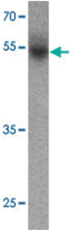 FOXA2, Rabbit, Polyclonal Antibody, Abnova 100 &mu;g | Buy Online | Abnova Corporation | Fisher Scientific