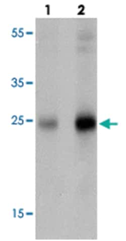 SHISA4, Rabbit, Polyclonal Antibody, Abnova 100 &mu;g | Buy Online | Abnova Corporation | Fisher Scientific