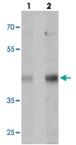MTERFD1 Rabbit anti-Human, Mouse, Polyclonal Antibody, Abnova 100&mu;g;