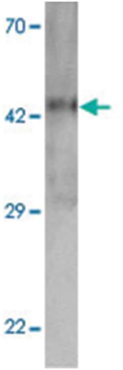 MTERFD2 Rabbit anti-Human, Mouse, Rat, Polyclonal Antibody, Abnova 100 &mu;g | Buy Online | Abnova Corporation | Fisher Scientific