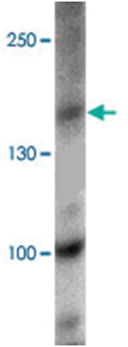 KANK1, Rabbit, Polyclonal Antibody, Abnova 100&mu;g; Unlabeled:Antibodies,
