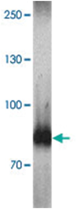 WAC Rabbit anti-Human, Mouse, Rat, Polyclonal Antibody, Abnova 100&mu;g;