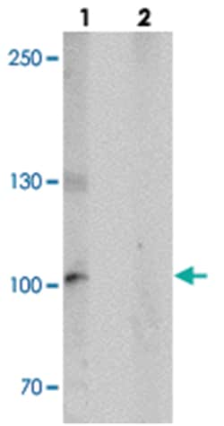 KANK2 Rabbit anti-Human, Mouse, Rat, Polyclonal Antibody, Abnova 100&mu;g;
