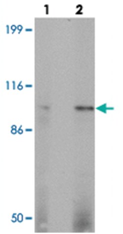 KANK3, Rabbit, Polyclonal Antibody, Abnova 100&mu;g; Unlabeled:Antibodies,