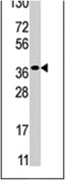 RBKS, Rabbit, Polyclonal Antibody, Abnova 400&mu;L; Unlabeled:Antibodies,