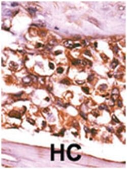 RBKS, Rabbit, Polyclonal Antibody, Abnova 400&mu;L; Unlabeled:Antibodies,