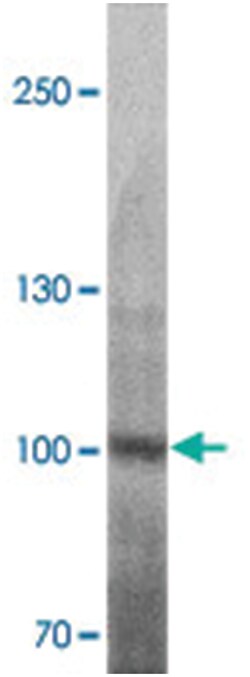 ULK2, Rabbit, Polyclonal Antibody, Abnova 100 &mu;g | Buy Online | Abnova Corporation | Fisher Scientific