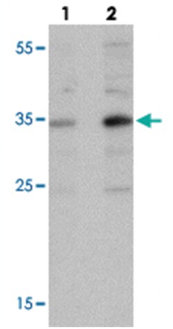 APOE Rabbit anti-Human, Mouse, Rat, Polyclonal Antibody, Abnova 100 &mu;g | Buy Online | Abnova Corporation | Fisher Scientific