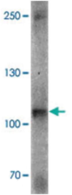 DIS3, Rabbit, Polyclonal Antibody, Abnova 100 &mu;g | Buy Online | Abnova Corporation | Fisher Scientific