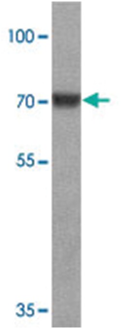 DDX41, Rabbit, Polyclonal Antibody, Abnova 100&mu;g; Unlabeled:Antibodies,