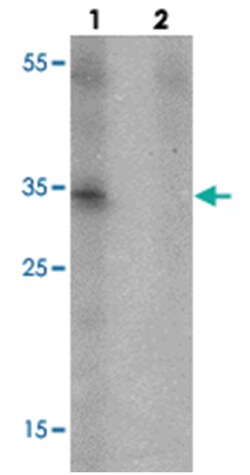 UNG Rabbit anti-Human, Mouse, Polyclonal Antibody, Abnova 100 &mu;g | Buy Online | Abnova Corporation | Fisher Scientific