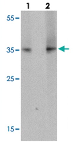 TLX1 Rabbit anti-Human, Mouse, Rat, Polyclonal Antibody, Abnova 100&mu;g;
