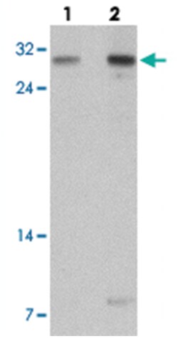 TLX2 Rabbit anti-Human, Mouse, Rat, Polyclonal Antibody, Abnova 100&mu;g;