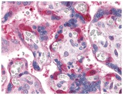 RIPK1 Rabbit anti-Human, Polyclonal Antibody, Abnova 100 &mu;g | Buy Online | Abnova Corporation | Fisher Scientific