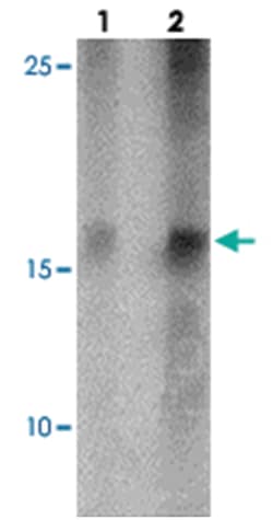 GABARAP Rabbit anti-Human, Mouse, Rat, Polyclonal Antibody, Abnova 100 &mu;g | Buy Online | Abnova Corporation | Fisher Scientific