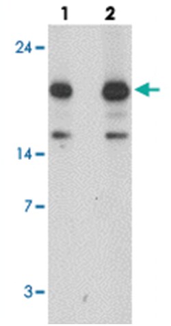 NRAS Rabbit anti-Human, Mouse, Rat, Polyclonal Antibody, Abnova 100 &mu;g | Buy Online | Abnova Corporation | Fisher Scientific