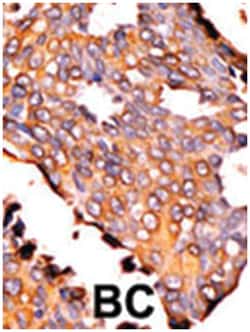 RFK, Rabbit, Polyclonal Antibody, Abnova 400&mu;L; Unlabeled:Antibodies,