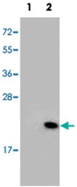 RFK, Rabbit, Polyclonal Antibody, Abnova 400&mu;L; Unlabeled:Antibodies,