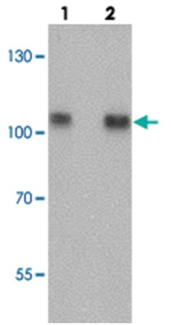 TRIM24 Rabbit anti-Human, Mouse, Rat, Polyclonal Antibody, Abnova 100 &mu;g | Buy Online | Abnova Corporation | Fisher Scientific