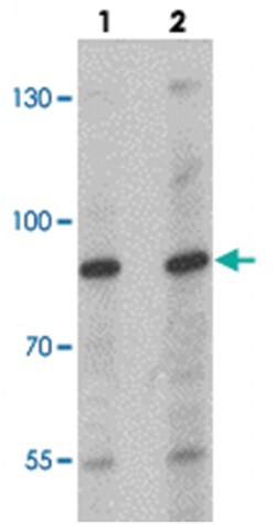 NCBP1, Rabbit, Polyclonal Antibody, Abnova 100 &mu;g | Buy Online | Abnova Corporation | Fisher Scientific