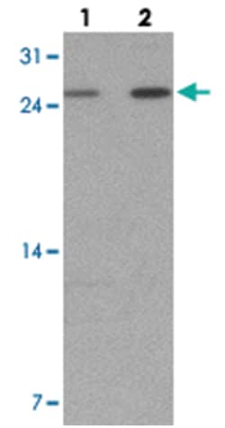 KHDC1 Rabbit anti-Human, Mouse, Rat, Polyclonal Antibody, Abnova 100 &mu;g | Buy Online | Abnova Corporation | Fisher Scientific