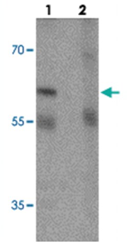 ESR1 Rabbit anti-Human, Mouse, Rat, Polyclonal Antibody, Abnova 100&mu;g;