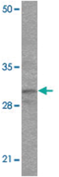 TFPI, Rabbit, Polyclonal Antibody, Abnova 100 &mu;g | Buy Online | Abnova Corporation | Fisher Scientific