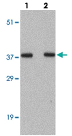 SPP1 Rabbit anti-Human, Mouse, Rat, Polyclonal Antibody, Abnova 100&mu;g;