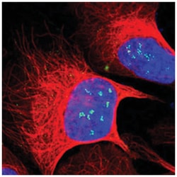 ZNF275, Rabbit, Polyclonal Antibody, Abnova 100 &mu;L | Buy Online | Abnova Corporation | Fisher Scientific