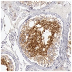 RIMBP3, Rabbit, Polyclonal Antibody, Abnova 100 &mu;L | Buy Online | Abnova Corporation | Fisher Scientific