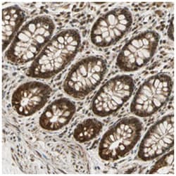 ZNF135, Rabbit, Polyclonal Antibody, Abnova 100&mu;L; Unlabeled:Antibodies,