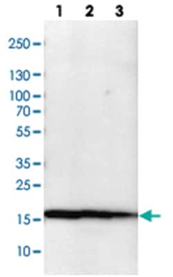 NME1-NME2, Rabbit, Polyclonal Antibody, Abnova 100&mu;L; Unlabeled:Antibodies,