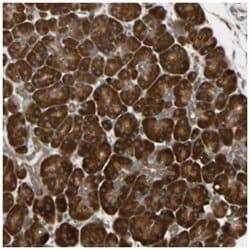 NME1-NME2, Rabbit, Polyclonal Antibody, Abnova 100&mu;L; Unlabeled:Antibodies,