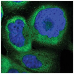 NME1-NME2, Rabbit, Polyclonal Antibody, Abnova 100&mu;L; Unlabeled:Antibodies,