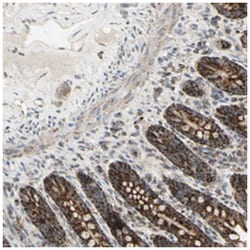 GLOD5, Rabbit, Polyclonal Antibody, Abnova 100 &mu;L | Buy Online | Abnova Corporation | Fisher Scientific