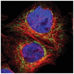 GLOD5, Rabbit, Polyclonal Antibody, Abnova 100 &mu;L | Buy Online | Abnova Corporation | Fisher Scientific