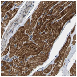 HIGD2BP, Rabbit, Polyclonal Antibody, Abnova 100 &mu;L | Buy Online | Abnova Corporation | Fisher Scientific