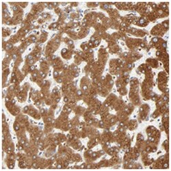 MAGEB17, Rabbit, Polyclonal Antibody, Abnova 100μL; Unlabeled:Antibodies,