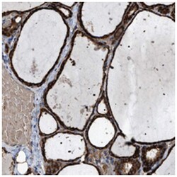 SELM, Rabbit, Polyclonal Antibody, Abnova 100 &mu;L | Buy Online | Abnova Corporation | Fisher Scientific