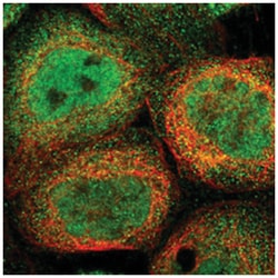 SELM, Rabbit, Polyclonal Antibody, Abnova 100 &mu;L | Buy Online | Abnova Corporation | Fisher Scientific