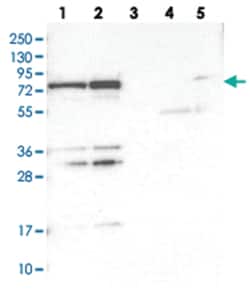 PTCD1, Rabbit, Polyclonal Antibody, Abnova 100 &mu;L | Buy Online | Abnova Corporation | Fisher Scientific