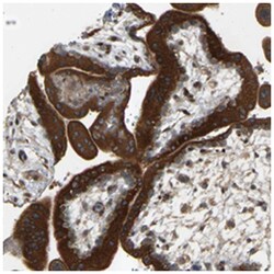 PTCD1, Rabbit, Polyclonal Antibody, Abnova 100 &mu;L | Buy Online | Abnova Corporation | Fisher Scientific