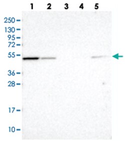 NSUN7, Rabbit, Polyclonal Antibody, Abnova 100&mu;L; Unlabeled:Antibodies,