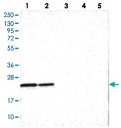 SOX7 Rabbit anti-Human, Polyclonal Antibody, Abnova 100 &mu;L | Buy Online | Abnova | Fisher Scientific