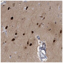 SOX7 Rabbit anti-Human, Polyclonal Antibody, Abnova 100 &mu;L | Buy Online | Abnova | Fisher Scientific