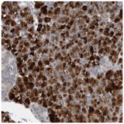 FBF1, Rabbit, Polyclonal Antibody, Abnova 100 &mu;L | Buy Online | Abnova Corporation | Fisher Scientific