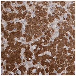 MUC12 Rabbit anti-Human, Polyclonal Antibody, Abnova 100 &mu;L | Buy Online | Abnova Corporation | Fisher Scientific