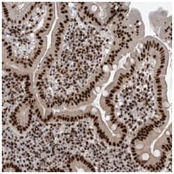 CDC2L2, Rabbit, Polyclonal Antibody, Abnova 100&mu;L; Unlabeled:Antibodies,