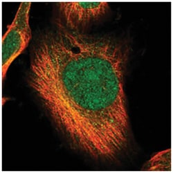 CDC2L2, Rabbit, Polyclonal Antibody, Abnova 100&mu;L; Unlabeled:Antibodies,