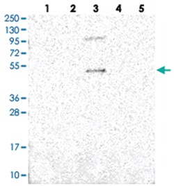 SLC10A5, Rabbit, Polyclonal Antibody, Abnova 100 &mu;L | Buy Online | Abnova Corporation | Fisher Scientific